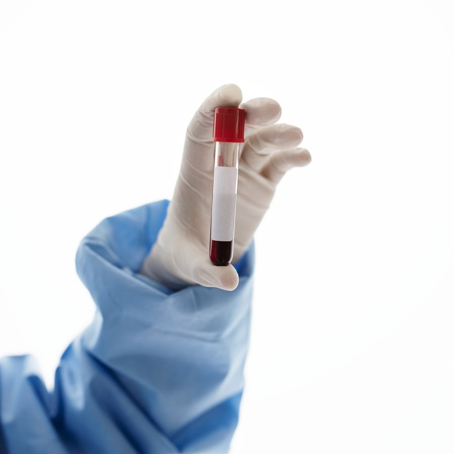 Concentré de Déleucocyté