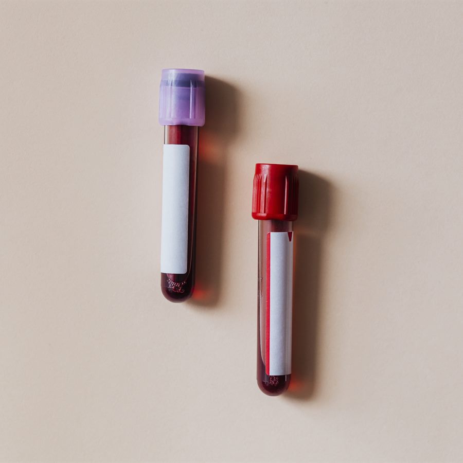 Concentré Érythrocytaire