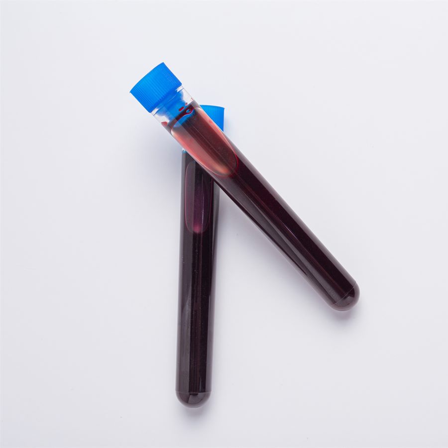 Plasma