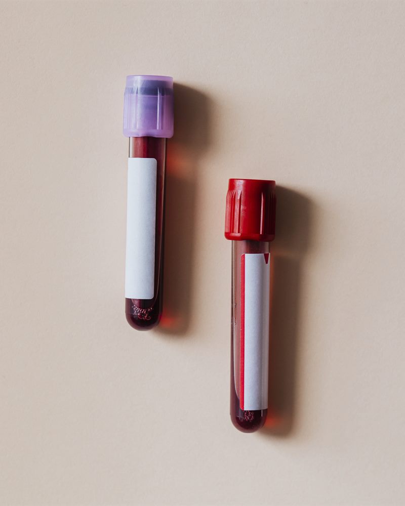 Concentré de globules rouges (CGR)