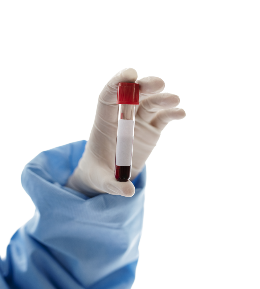 Tube de sang prélevé, présenté par un technicien du CNTSCI