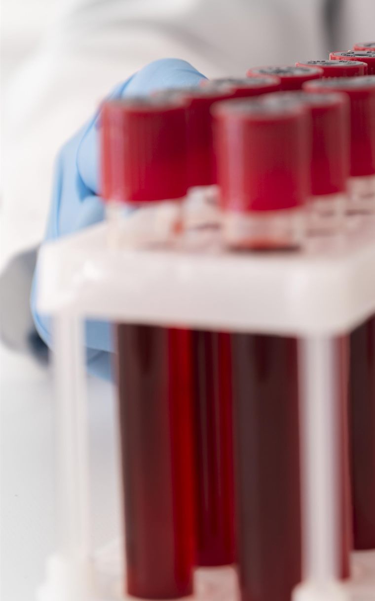 Examens médicaux de laboratoire